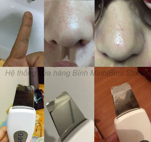 sủi da tẩy tế bào chết làm sạch da